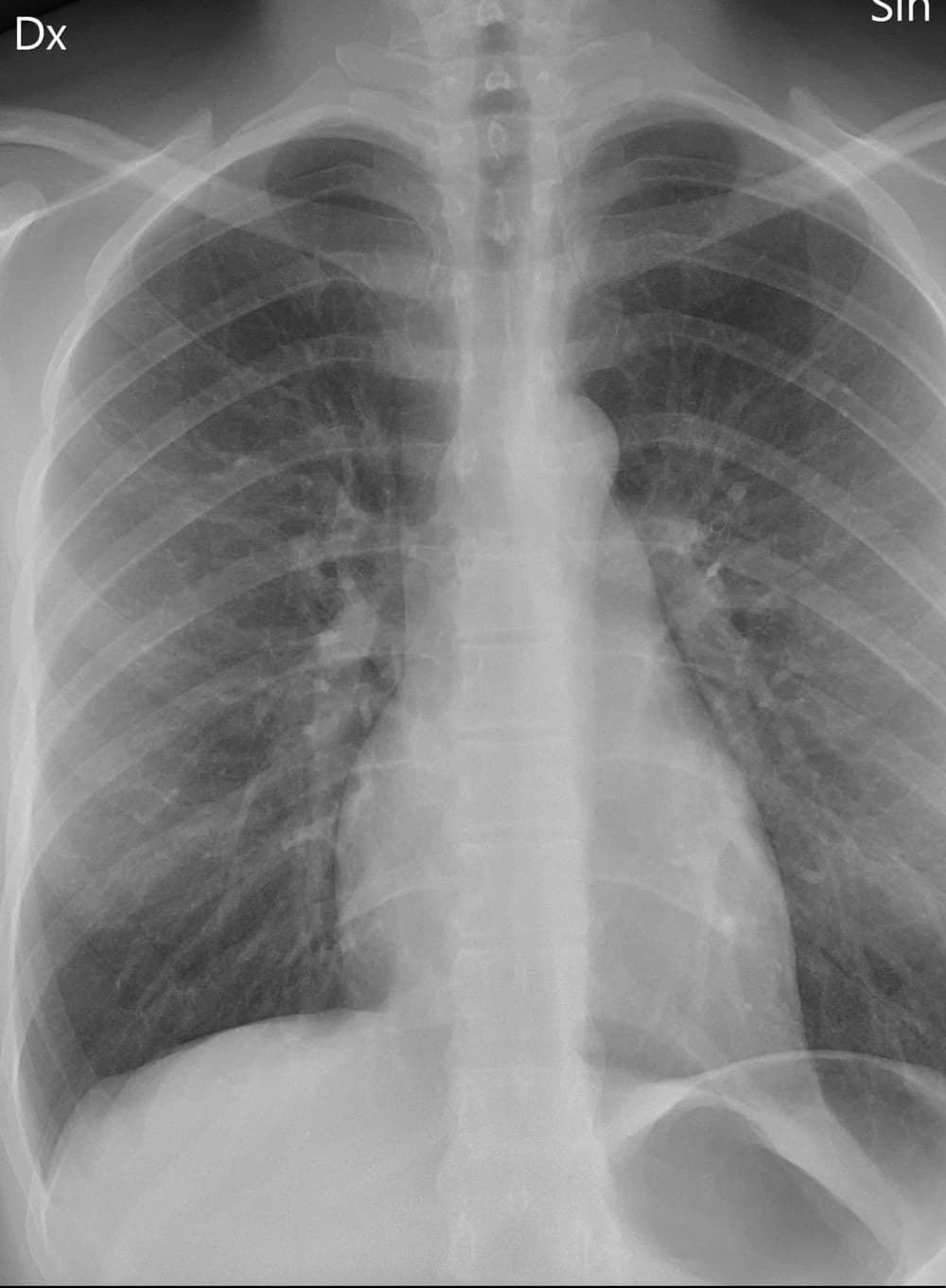 Chest X-ray used for a guided ABCDE interpretation walkthrough